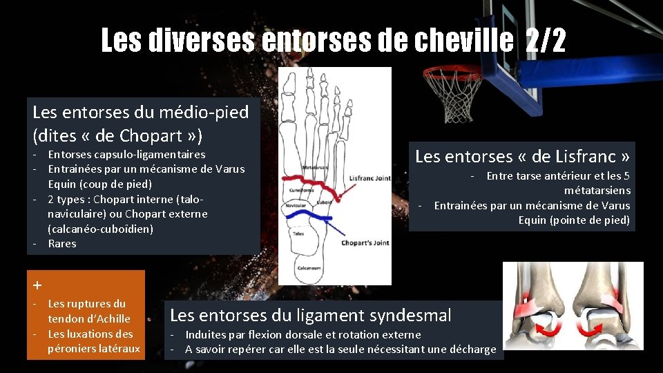 Les diverses entorses de cheville 2/2 Les entorses du médio-pied (dites « de Chopart