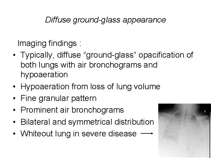 Diffuse ground-glass appearance Imaging findings : • Typically, diffuse “ground-glass” opacification of both lungs