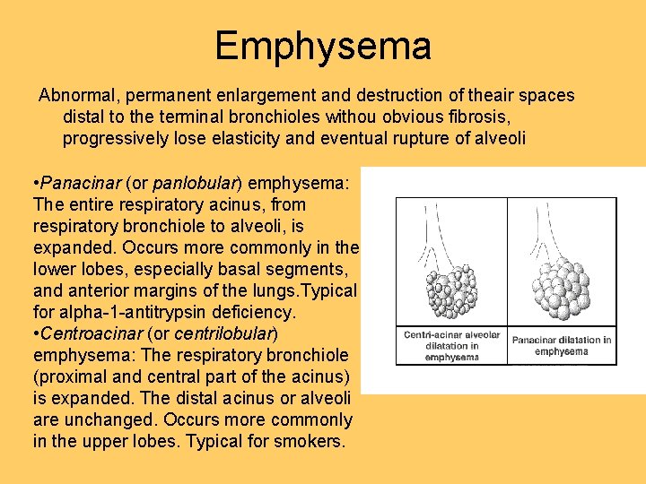 Emphysema Abnormal, permanent enlargement and destruction of theair spaces distal to the terminal bronchioles Emphysema Abnormal, permanent enlargement and destruction of theair spaces distal to the terminal bronchioles