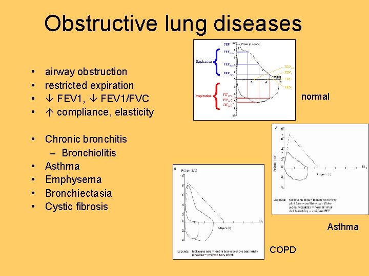 Obstructive lung diseases • • airway obstruction restricted expiration FEV 1, FEV 1/FVC compliance, Obstructive lung diseases • • airway obstruction restricted expiration FEV 1, FEV 1/FVC compliance,