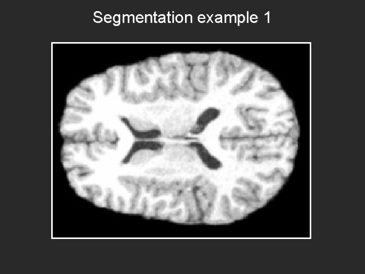 Segmentation example 1 