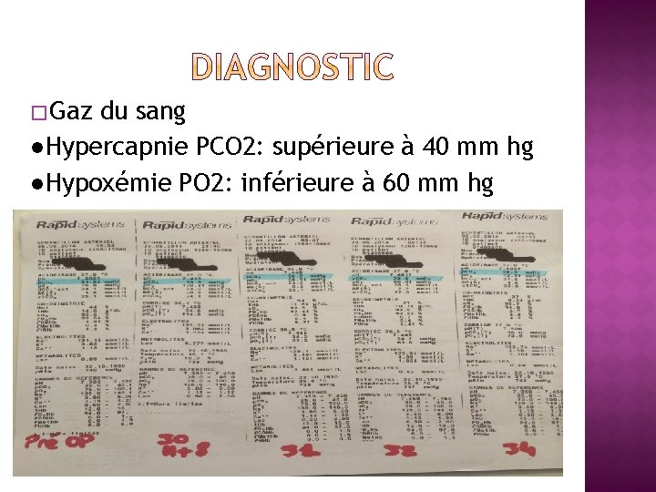 � Gaz du sang ●Hypercapnie PCO 2: supérieure à 40 mm hg ●Hypoxémie PO