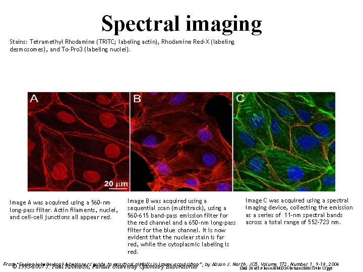 Spectral imaging Stains: Tetramethyl Rhodamine (TRITC; labeling actin), Rhodamine Red-X (labeling desmosomes), and To-Pro