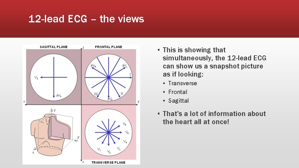 12 -lead ECG – the views ▪ This is showing that simultaneously, the 12