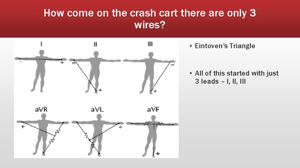 How come on the crash cart there are only 3 wires? ▪ Eintoven’s Triangle