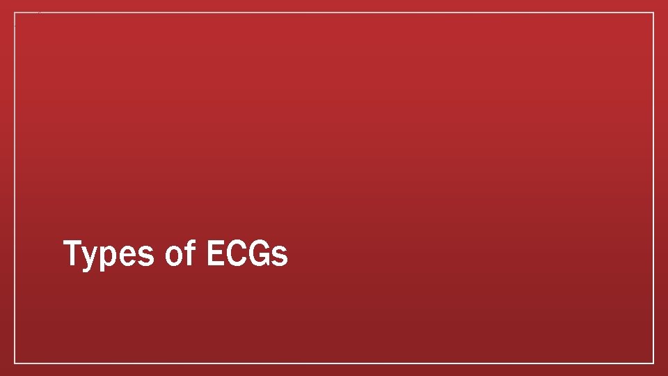 Types of ECGs 