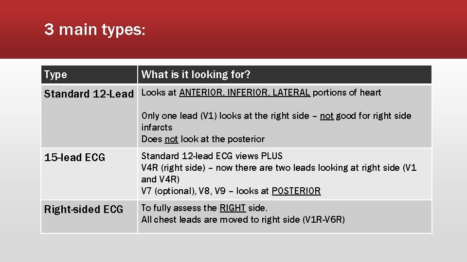 3 main types: Type What is it looking for? Standard 12 -Lead Looks at
