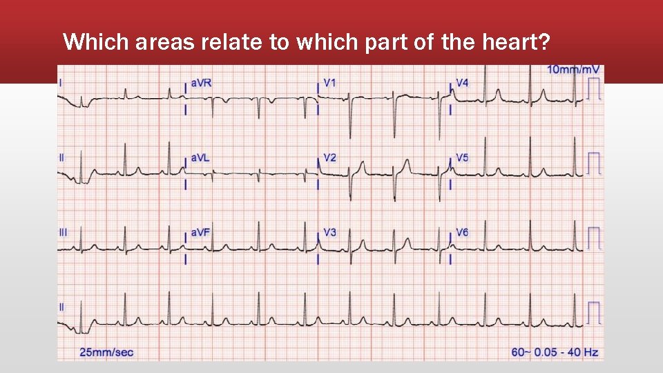 Which areas relate to which part of the heart? 