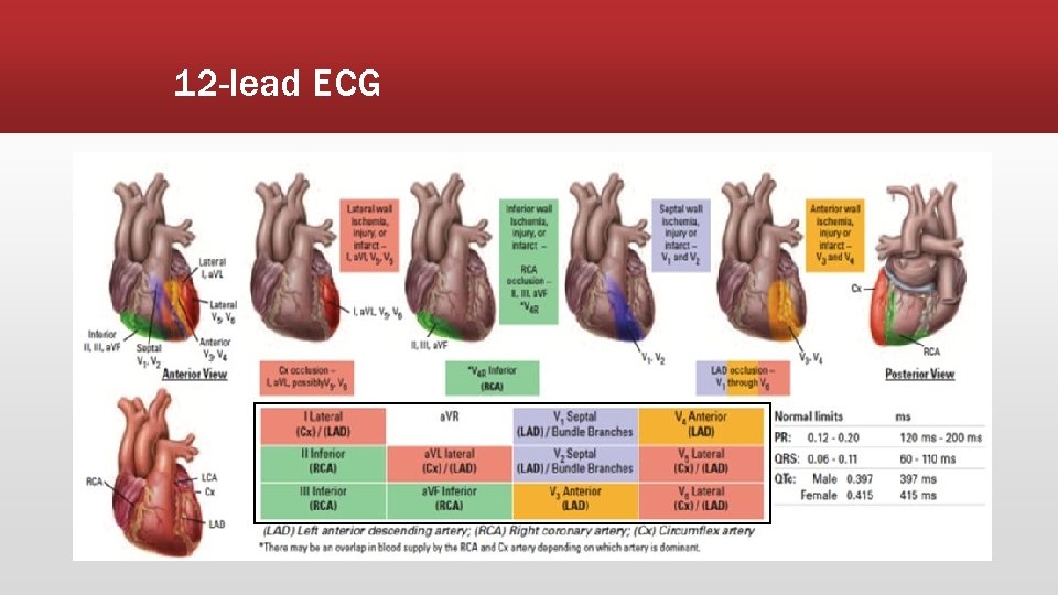 12 -lead ECG 