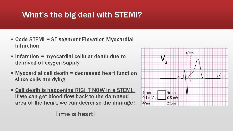 What’s the big deal with STEMI? ▪ Code STEMI = ST segment Elevation Myocardial