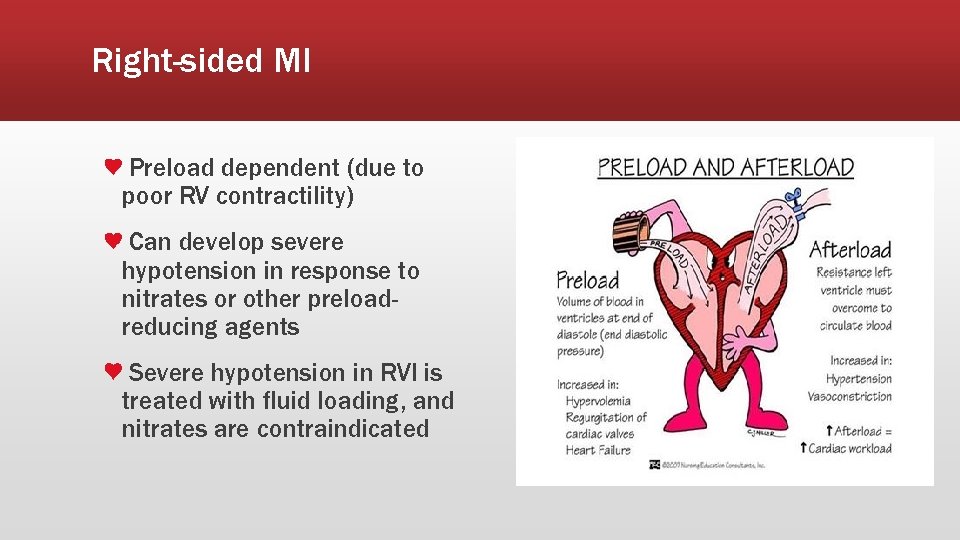 Right-sided MI Preload dependent (due to poor RV contractility) Can develop severe hypotension in
