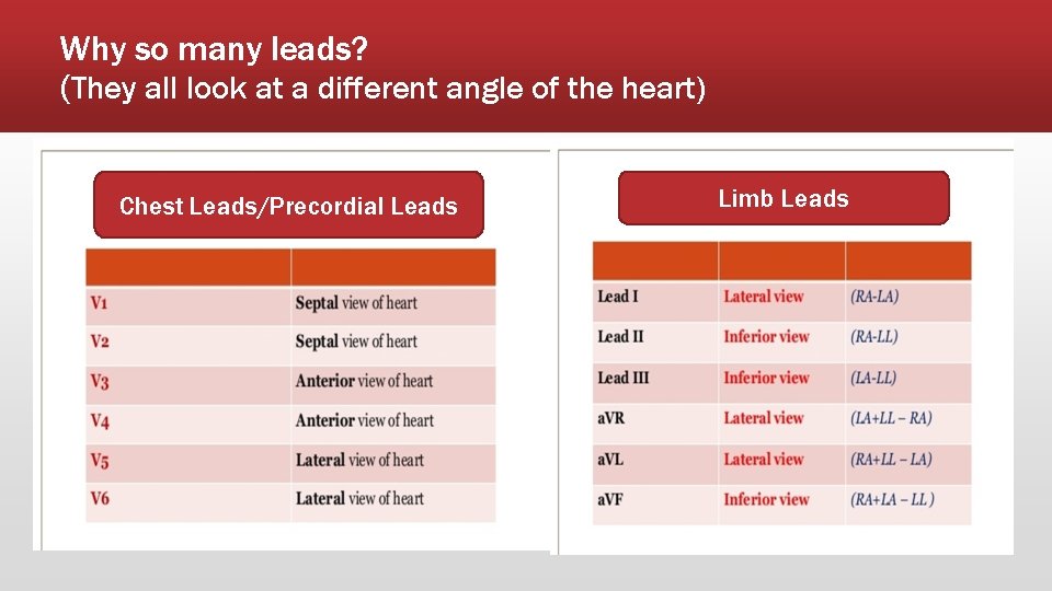 Why so many leads? (They all look at a different angle of the heart)