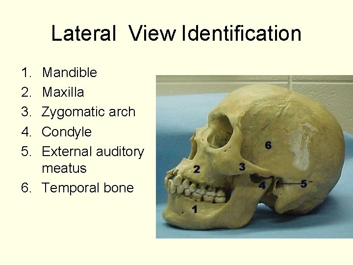Lateral View Identification 1. 2. 3. 4. 5. Mandible Maxilla Zygomatic arch Condyle External