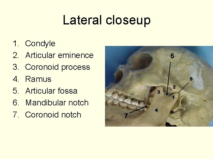 Lateral closeup 1. 2. 3. 4. 5. 6. 7. Condyle Articular eminence Coronoid process
