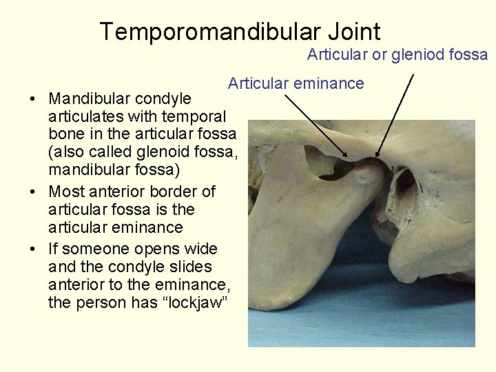 Temporomandibular Joint Articular or gleniod fossa Articular eminance • Mandibular condyle articulates with temporal