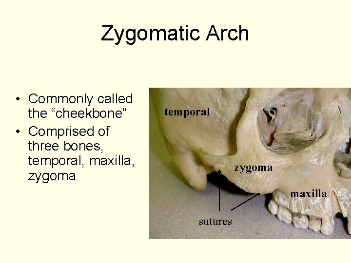 Zygomatic Arch • Commonly called the “cheekbone” • Comprised of three bones, temporal, maxilla,
