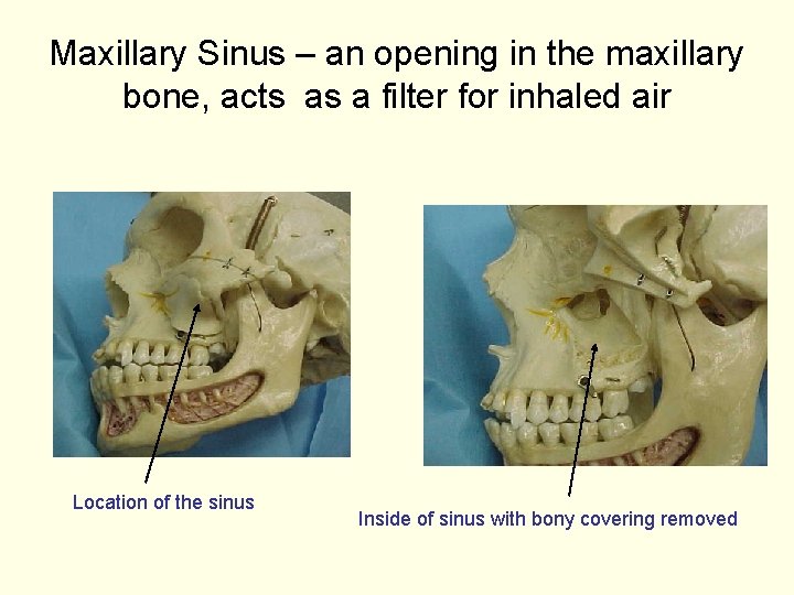 Maxillary Sinus – an opening in the maxillary bone, acts as a filter for