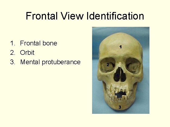 Frontal View Identification 1. Frontal bone 2. Orbit 3. Mental protuberance 