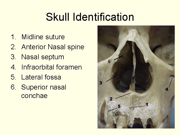 Skull Identification 1. 2. 3. 4. 5. 6. Midline suture Anterior Nasal spine Nasal