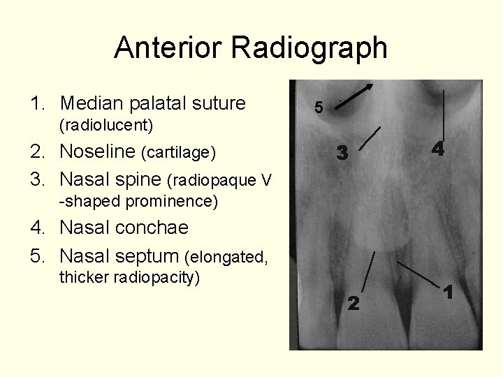 Anterior Radiograph 1. Median palatal suture (radiolucent) 2. Noseline (cartilage) 3. Nasal spine (radiopaque