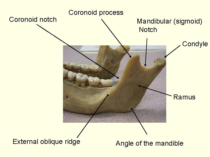 Coronoid notch Coronoid process Mandibular (sigmoid) Notch Condyle Ramus External oblique ridge Angle of