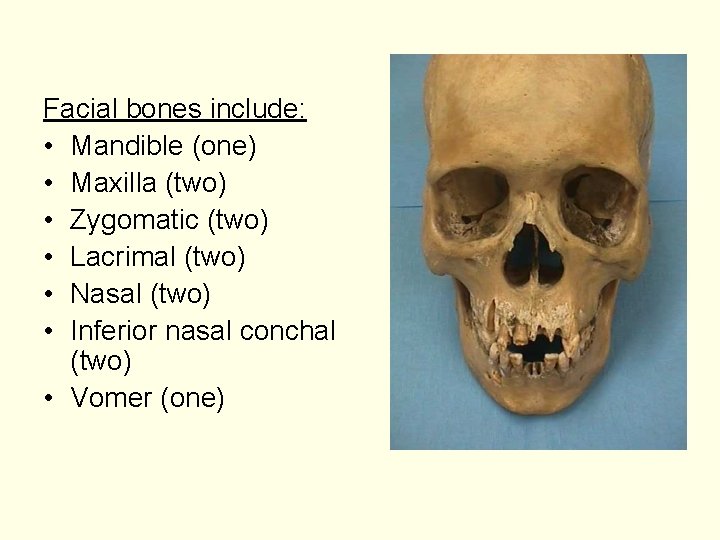Facial bones include: • Mandible (one) • Maxilla (two) • Zygomatic (two) • Lacrimal
