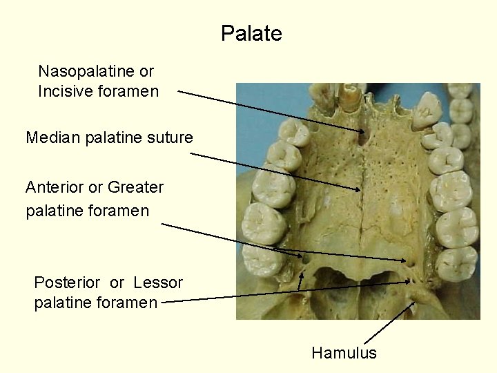 Palate Nasopalatine or Incisive foramen Median palatine suture Anterior or Greater palatine foramen Posterior