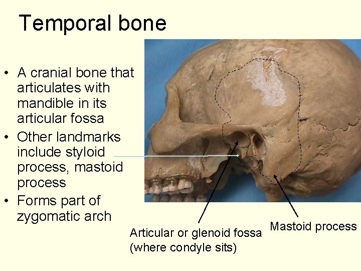 Temporal bone • A cranial bone that articulates with mandible in its articular fossa