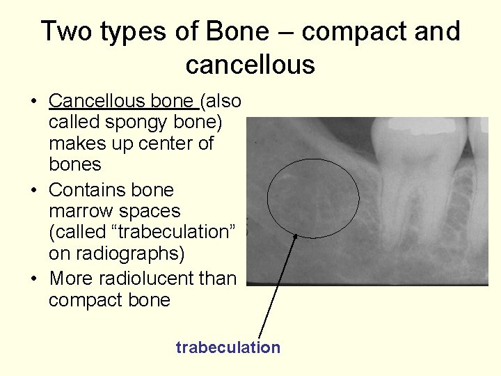 Two types of Bone – compact and cancellous • Cancellous bone (also called spongy
