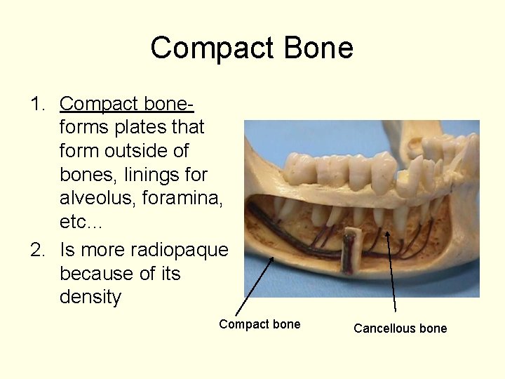 Compact Bone 1. Compact boneforms plates that form outside of bones, linings for alveolus,