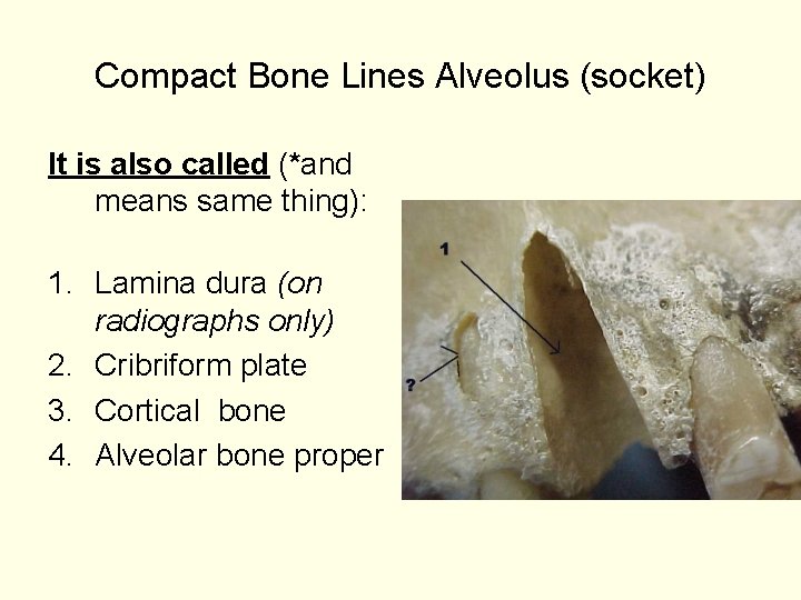 Compact Bone Lines Alveolus (socket) It is also called (*and means same thing): 1.