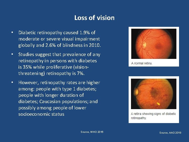 Loss of vision • Diabetic retinopathy caused 1. 9% of moderate or severe visual