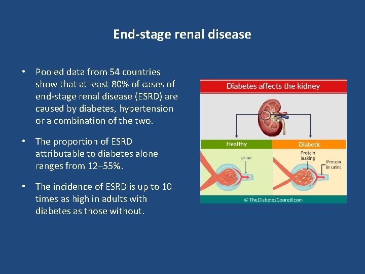 End-stage renal disease • Pooled data from 54 countries show that at least 80%