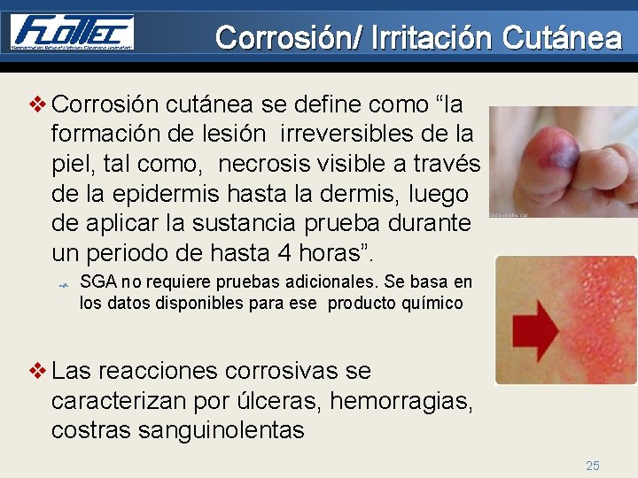 Corrosión/ Irritación Cutánea v Corrosión cutánea se define como “la formación de lesión irreversibles