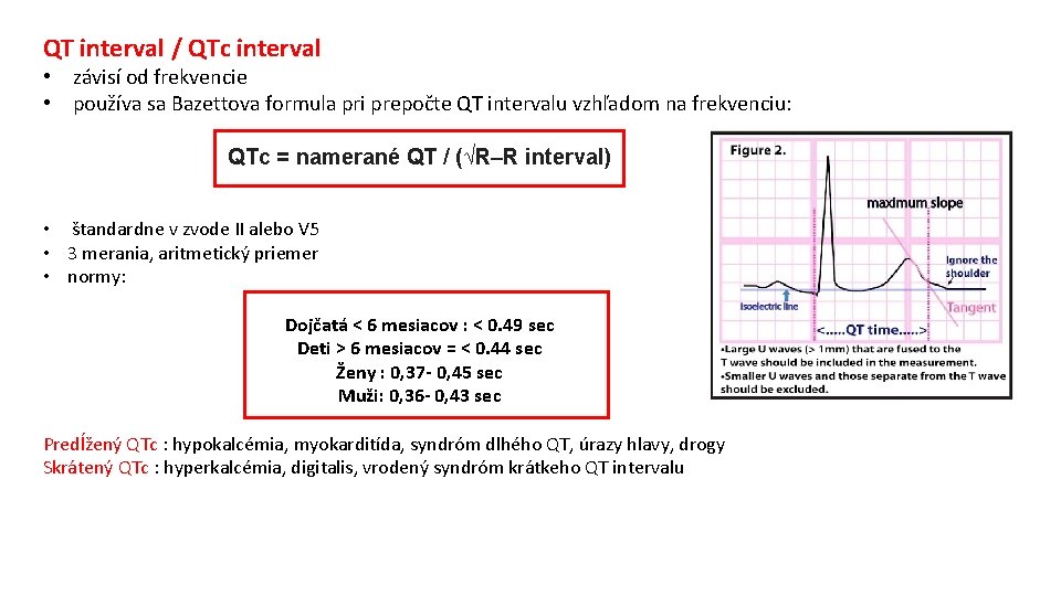 QT interval / QTc interval • závisí od frekvencie • používa sa Bazettova formula