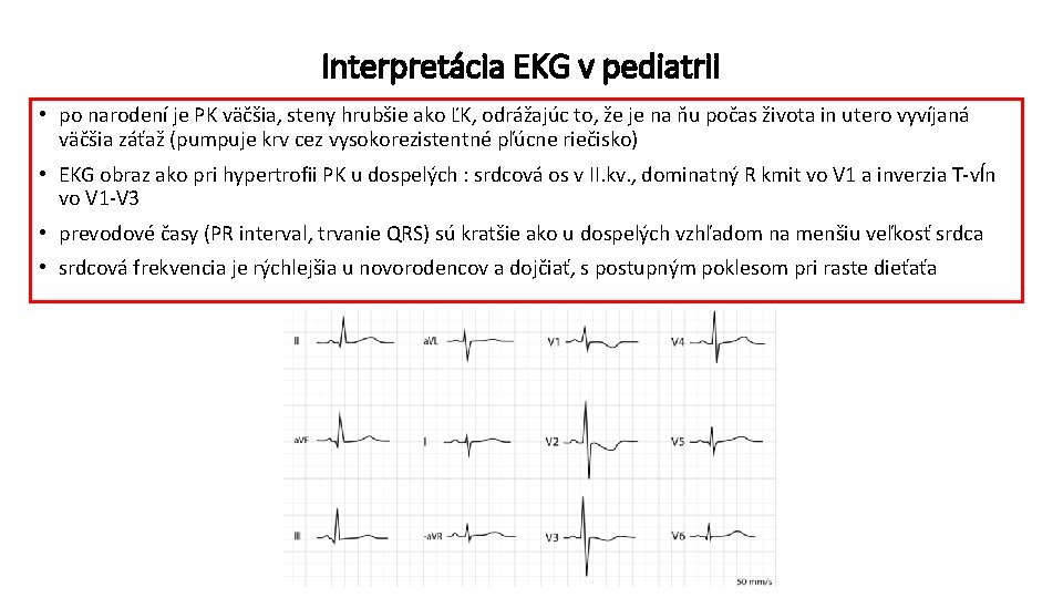 Interpretácia EKG v pediatrii • po narodení je PK väčšia, steny hrubšie ako ĽK,