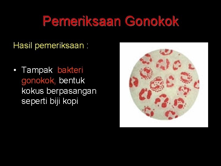 Pemeriksaan Gonokok Hasil pemeriksaan : • Tampak bakteri gonokok, bentuk kokus berpasangan seperti biji