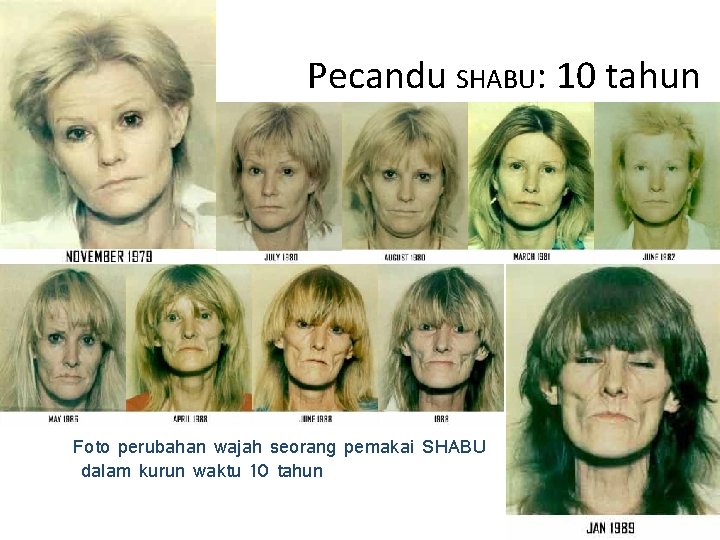 Pecandu SHABU: 10 tahun Foto perubahan wajah seorang pemakai SHABU dalam kurun waktu 10