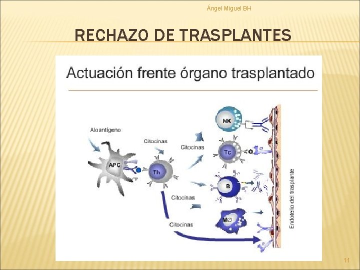 Ángel Miguel BH RECHAZO DE TRASPLANTES 11 