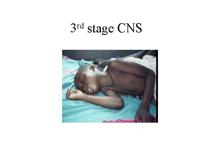 rd 3 stage CNS 