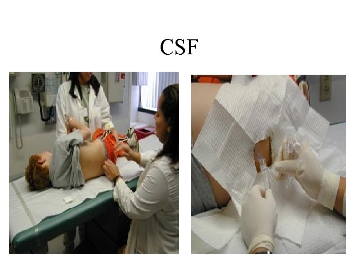 CSF 