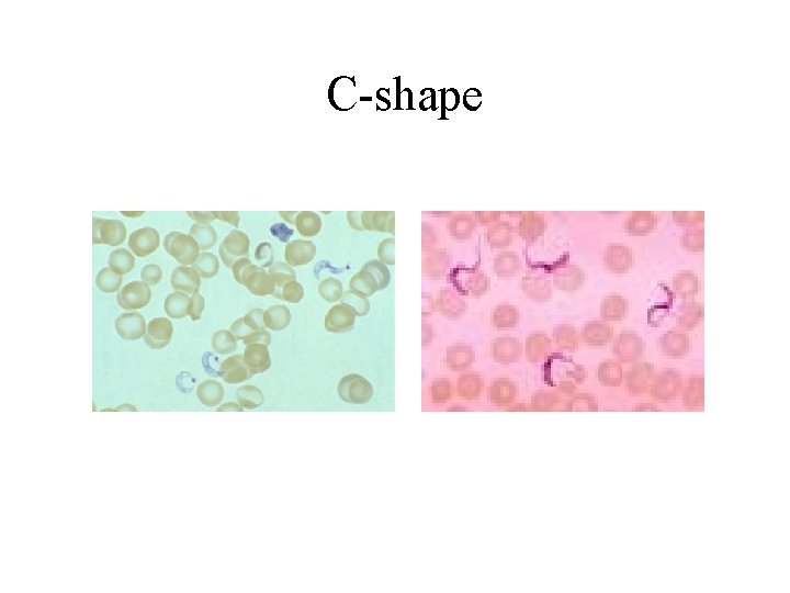 C-shape 