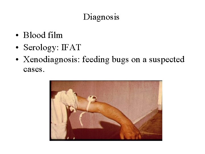Diagnosis • Blood film • Serology: IFAT • Xenodiagnosis: feeding bugs on a suspected