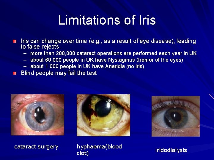 Limitations of Iris can change over time (e. g. , as a result of
