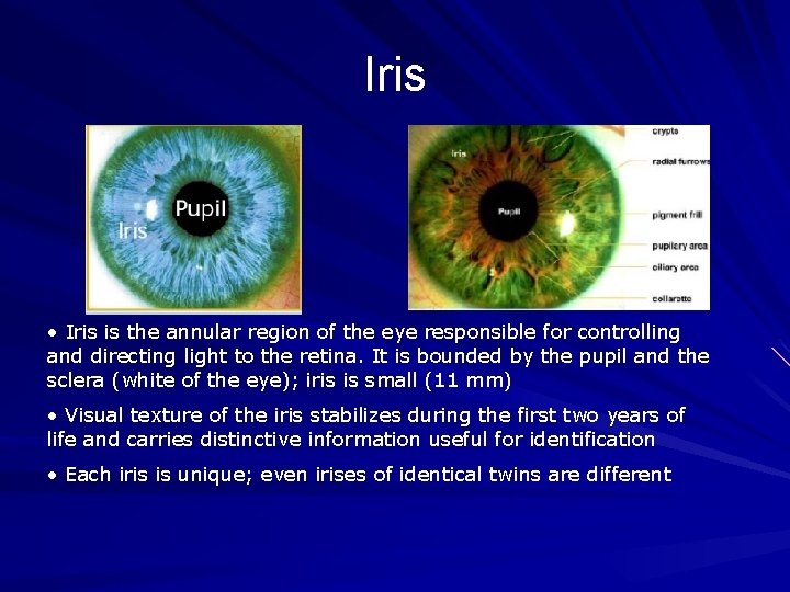 Iris • Iris is the annular region of the eye responsible for controlling and