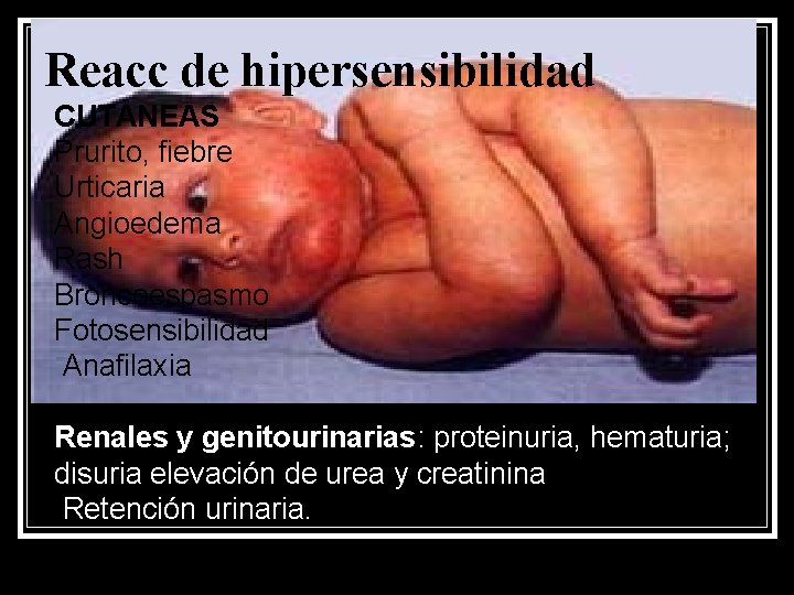 Reacc de hipersensibilidad CUTANEAS Prurito, fiebre Urticaria Angioedema Rash Broncoespasmo Fotosensibilidad Anafilaxia Renales y