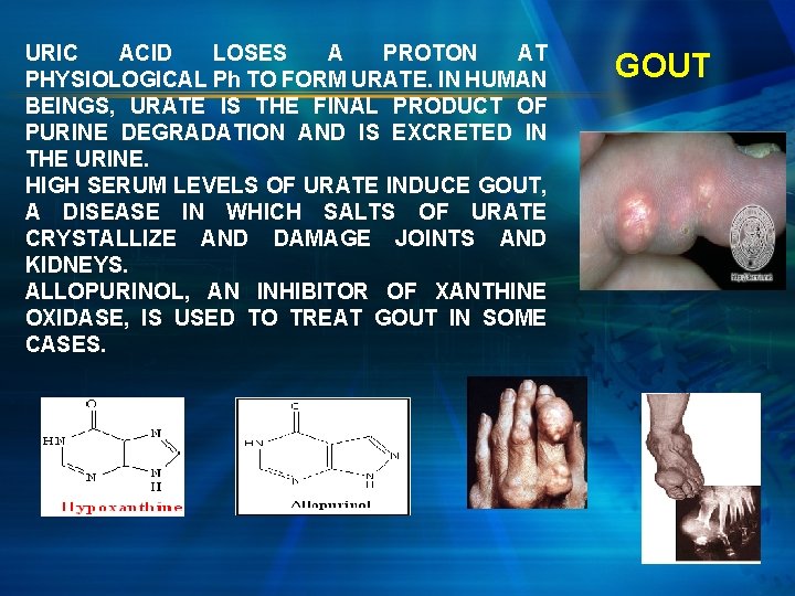 URIC ACID LOSES A PROTON AT PHYSIOLOGICAL Ph TO FORM URATE. IN HUMAN BEINGS,