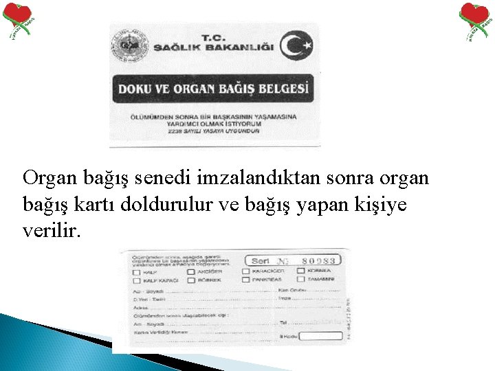 Organ bağış senedi imzalandıktan sonra organ bağış kartı doldurulur ve bağış yapan kişiye verilir.