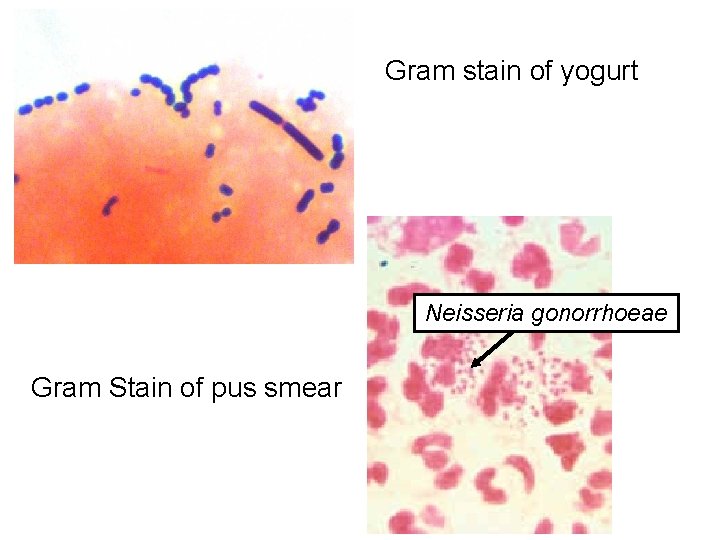 Gram stain of yogurt Neisseria gonorrhoeae Gram Stain of pus smear  Gram stain of yogurt Neisseria gonorrhoeae Gram Stain of pus smear