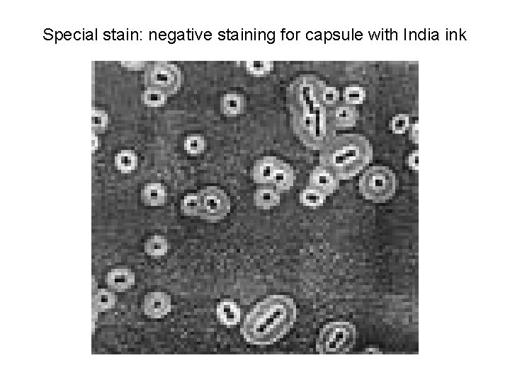 Special stain: negative staining for capsule with India ink  Special stain: negative staining for capsule with India ink